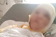 В Кишиневе мужчина облил кислотой свою жену и ребенка: агрессор задержан