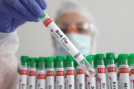 Первый в мире случай: житель Мексики заразился птичьим гриппом H5N2