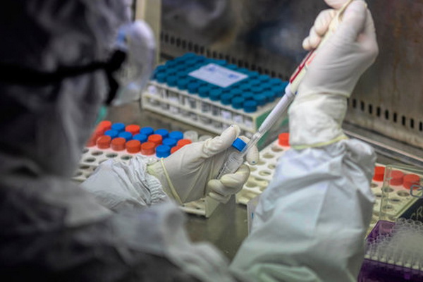 Минздрав Молдовы закупит 1 тысячу тестов для обнаружения коронавируса
