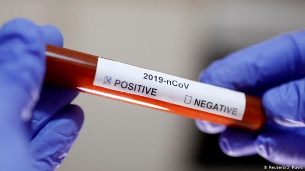 В Республике Молдова выявлены два новых случая заболевания коронавирусом