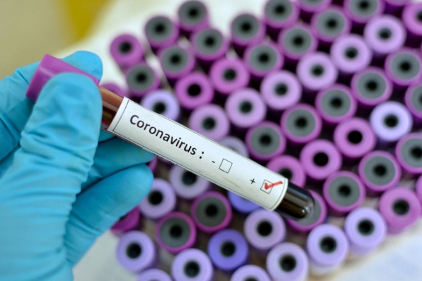 Более 100 новых случаев заболевания COVID-19 выявлено в Молдове