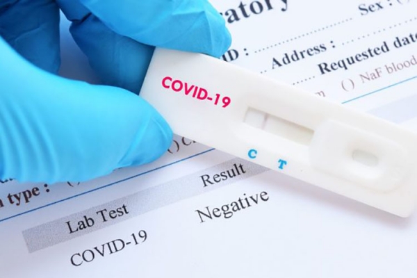 В Кагуле начала работу лаборатория по тестированию на COVID-19