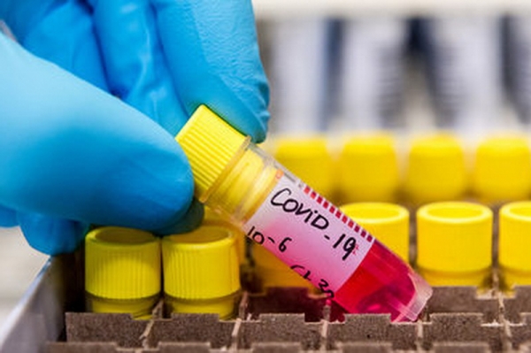 Минздрав: За выходные в Гагаузии выявили еще 45 инфицированных COVID-19