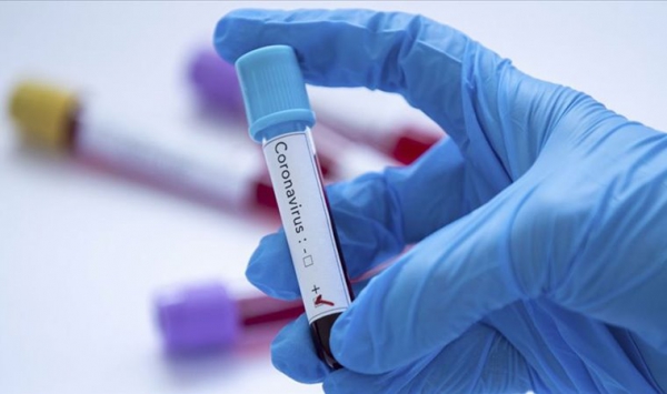 Последние данные КЧС: В Гагаузии коронавирус диагностирован у 301 человека