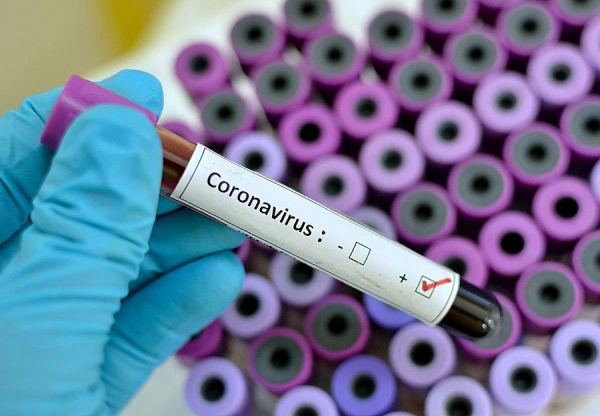 В Гагаузии за сутки выявили 29 новых случаев коронавируса