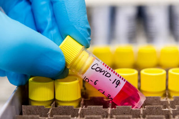 Более 30 новых случаев инфицирования COVID-19 выявлено в Гагаузии
