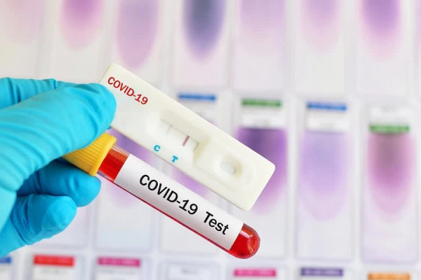 Два летальных исхода и 55 новых случаев заражения: динамика COVID-19 в Гагаузии за сутки