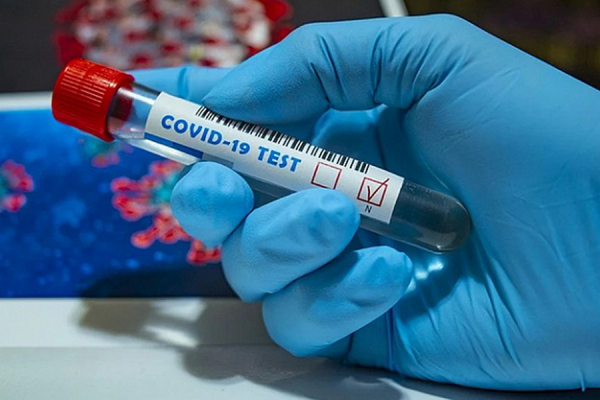 В Гагаузии от коронавируса вылечились 815 из 1 тысячи 348 заболевших