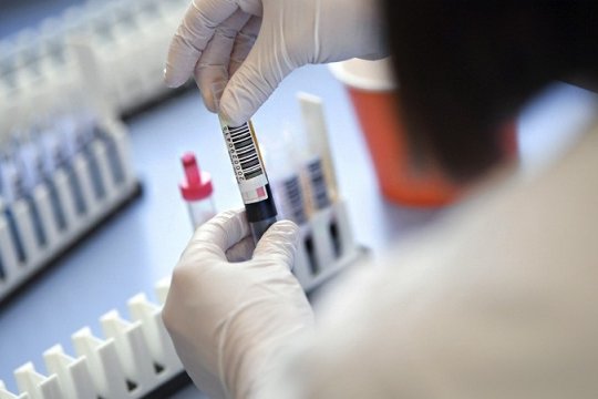 В Гагаузии за сутки выявили 19 новых случаев коронавируса