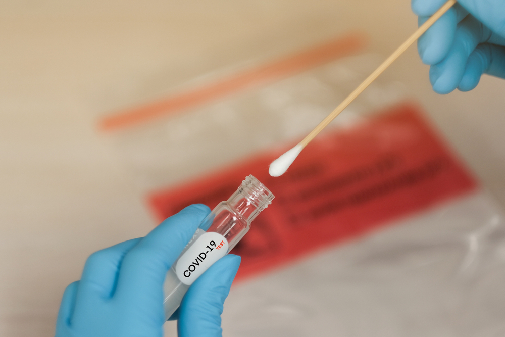 26 положительных тестов из 62: данные о коронавирусе в Гагаузии за сутки