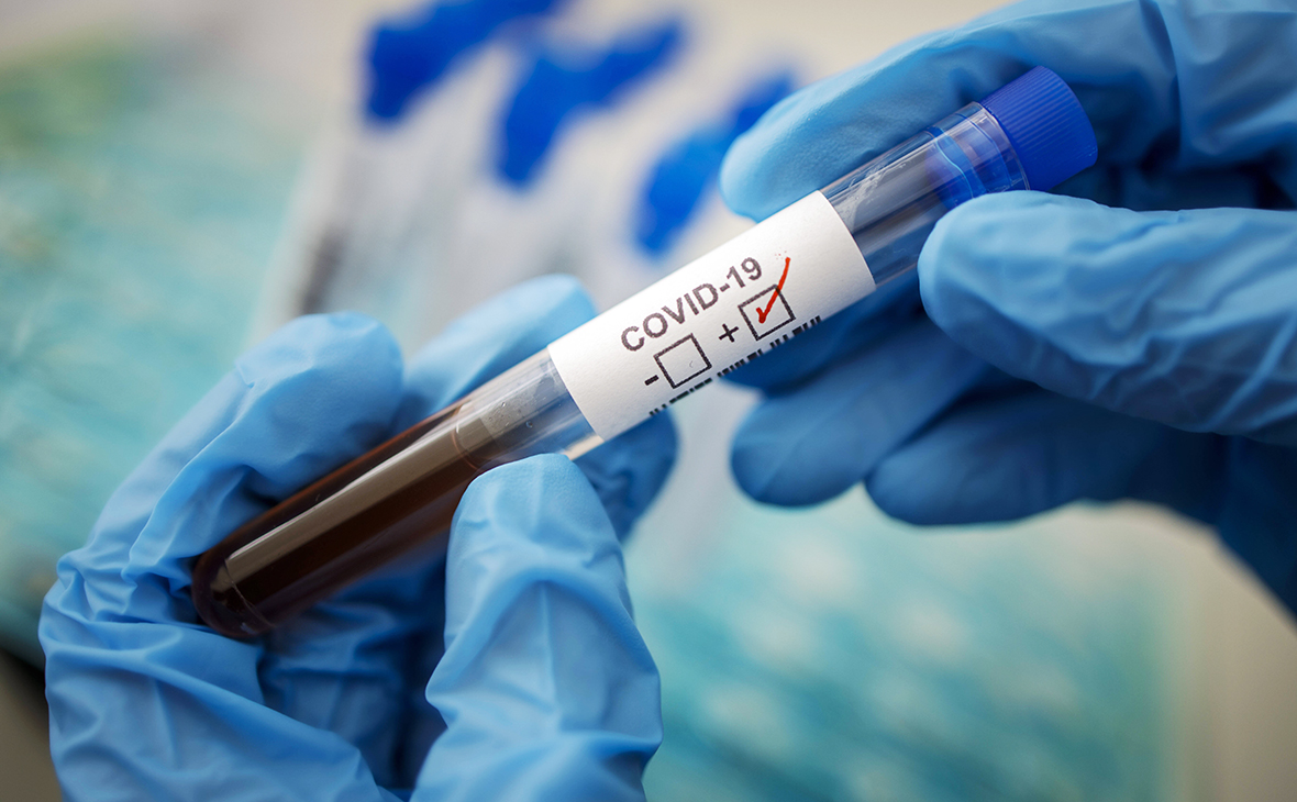 В Гагаузии за прошедшие сутки зарегистрирован 21 случай заболевания коронавирусом