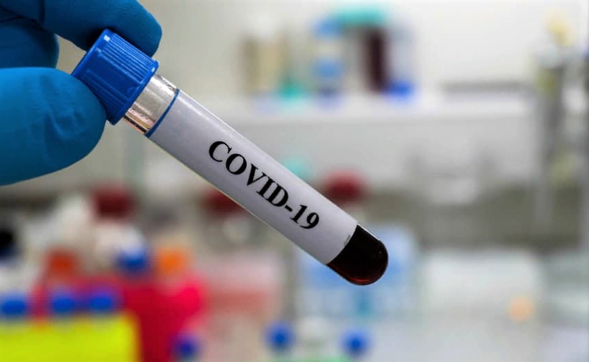 23 положительных теста из 63: данные о коронавирусе в Гагаузии за сутки