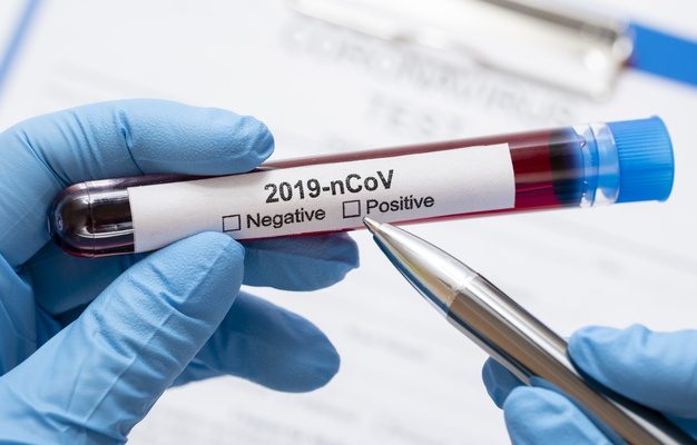 В Гагаузии за сутки выявили 8 новых случаев заболевания коронавирусом