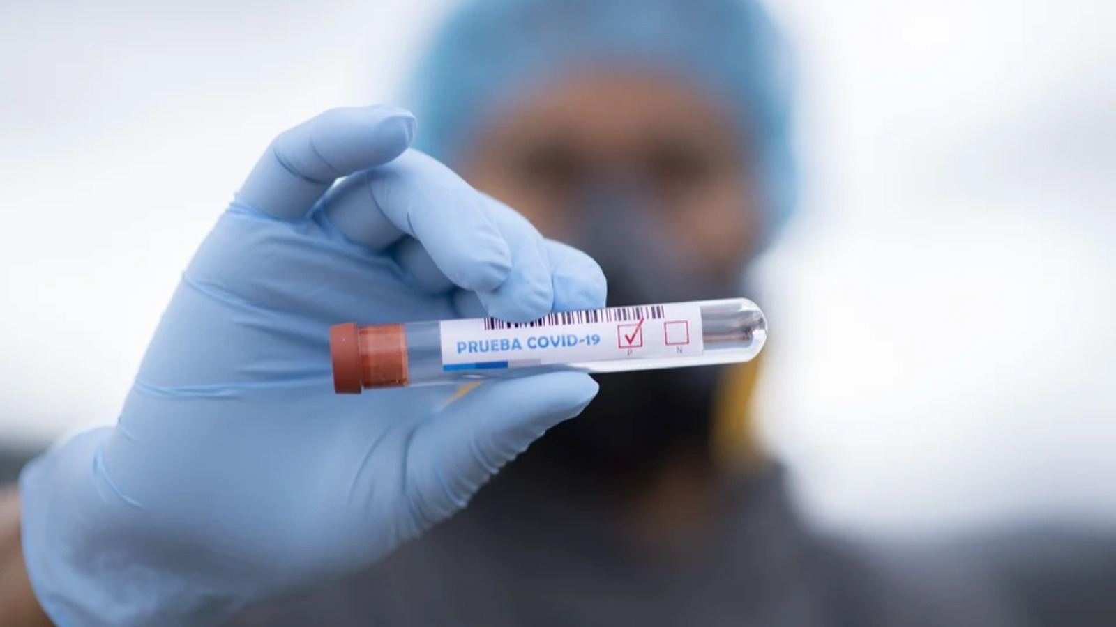 37 положительных тестов из 73: обновленные данные о коронавирусе в Гагаузии за сутки