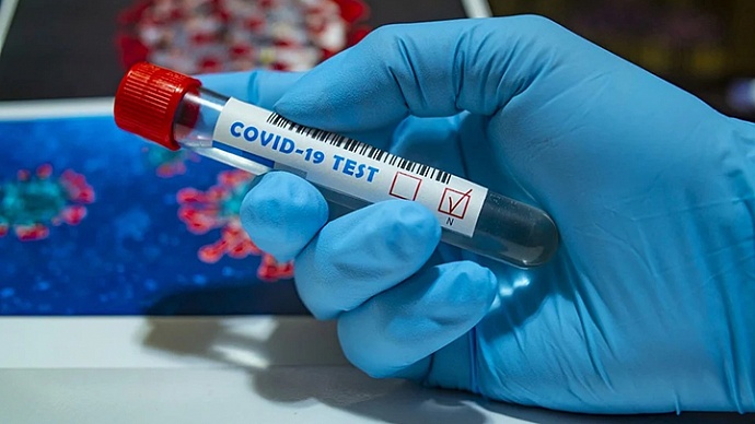 В Гагаузии за сутки зарегистрировано 16 случаев заболевания коронавирусом