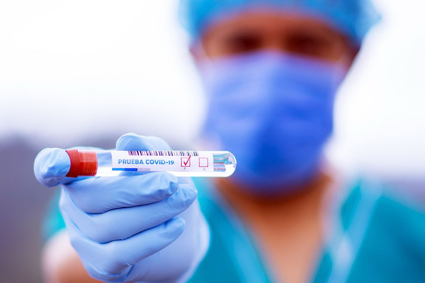 Коронавирус в Гагаузии за сутки: заболели 22 человека, один пациент скончался