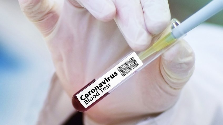 В Гагаузии за последние сутки не выявлено ни одного случая заболевания коронавирусом