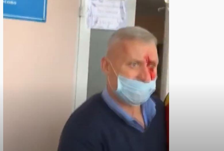 Примара села Кирсово избили на рабочем месте