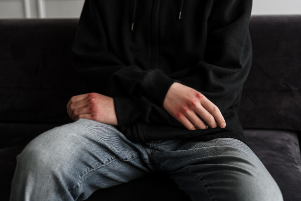 Шокирующий случай в Молдове: 16-летний подросток изнасиловал 7-летнюю девочку