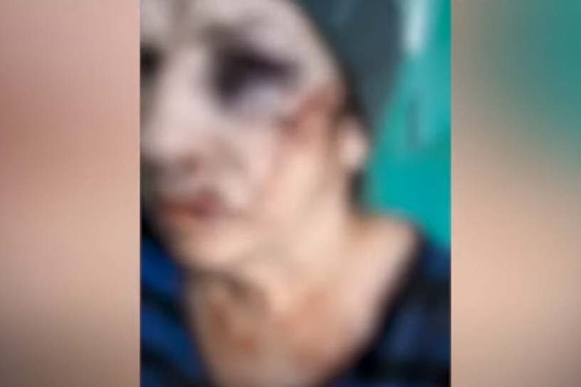 «Напиваются и дерутся»: в Кишиневе муж едва не выбил в драке жене глаз