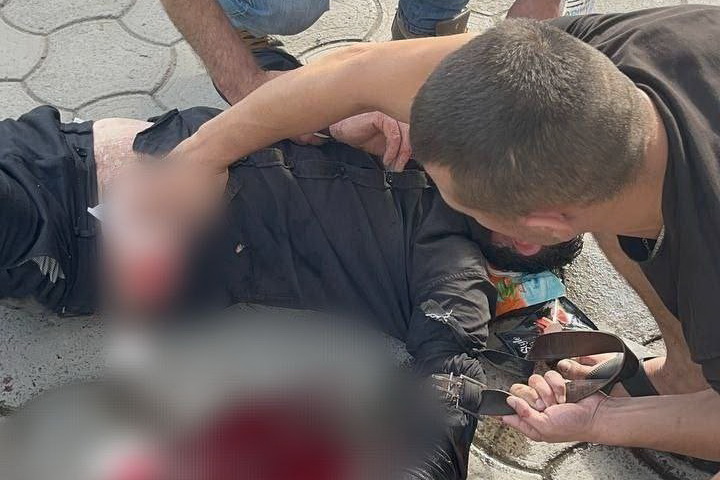 В Бельцах мужчину ранили ножом в живот. Медицинскую помощь оказал карабинер