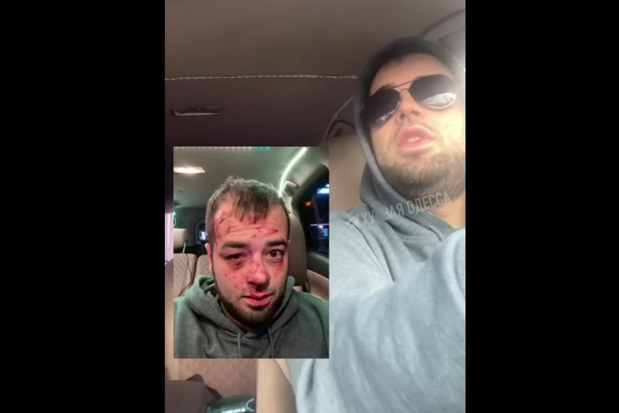 Ты знаешь, кто мы такие?: украинские телеграм-каналы сообщили об избиении таксиста в Кишиневе беженцами
