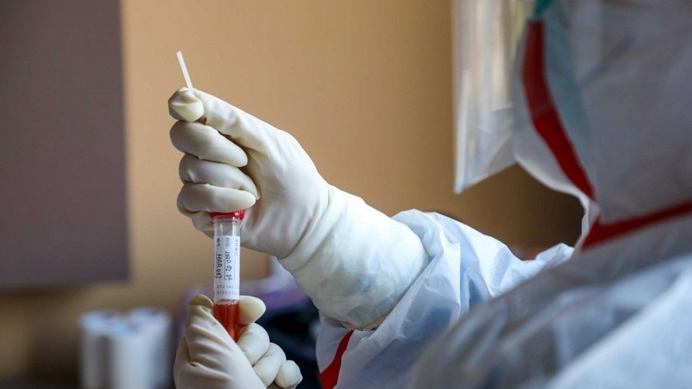 В Гагаузии за последние сутки не выявлено случаев заболевания коронавирусом 