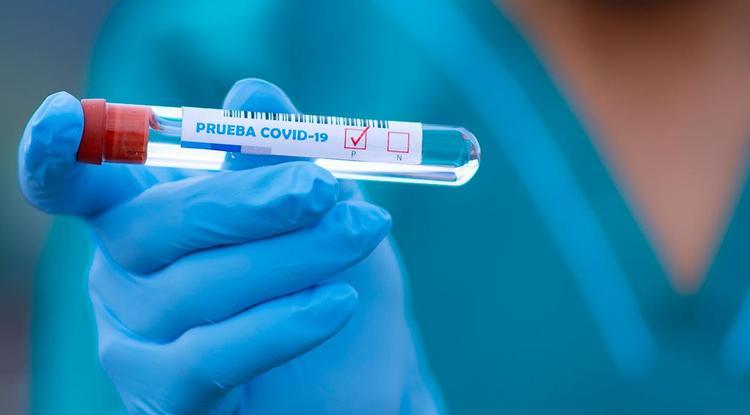 В Гагаузии за выходные у 3 человек выявили COVID-19. Все госпитализированы 