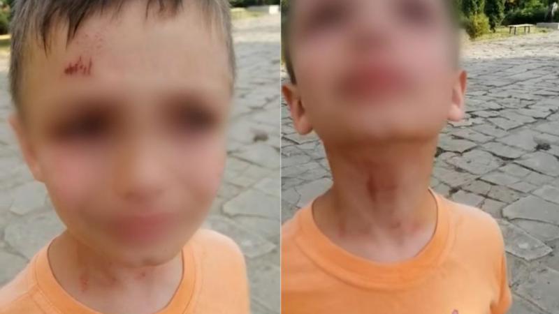 Против сотрудника Погранполиции, избившего детей в Басарабяске, возбудили дело